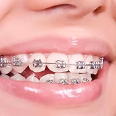 Servicio de ortodoncia - Clínica Dental GALANA